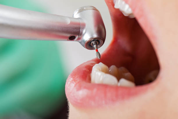 Best Emergency Treatment for Dental Infections or Abscesses in , TN